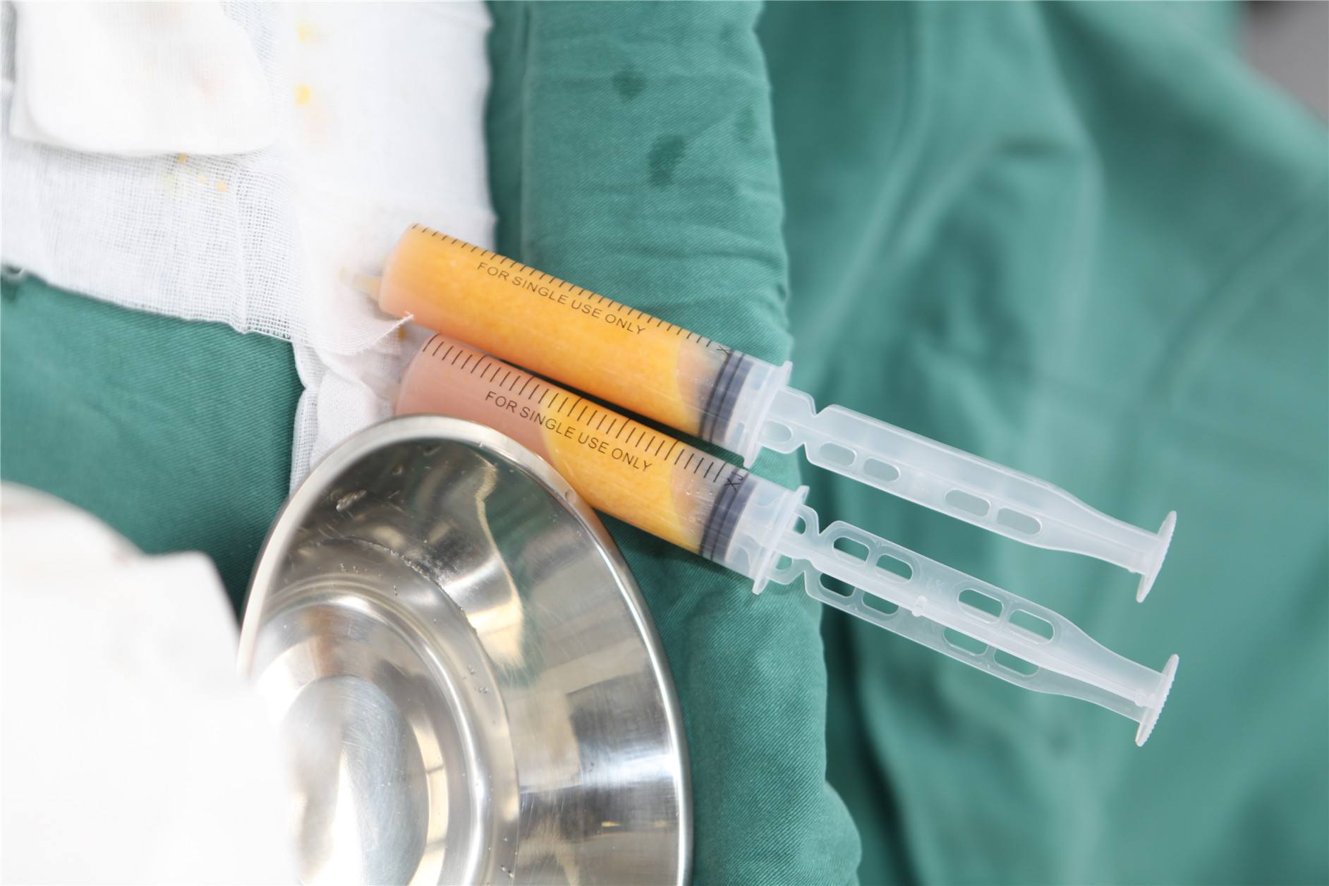 全脸填充纯脂肪和svf有什么区别,干细胞和脂肪填充的区别