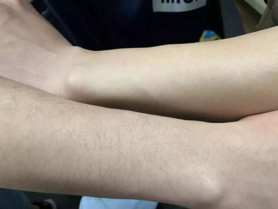 脱毛好物推荐,超平价脱毛推荐