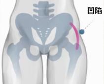 翘臀的标准是臀部肌肉紧实有力,扁平臀练出翘臀用什么器械最有效