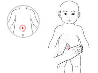 宝宝反复湿疹腹泻什么原因,宝宝湿疹大便臭怎么调理