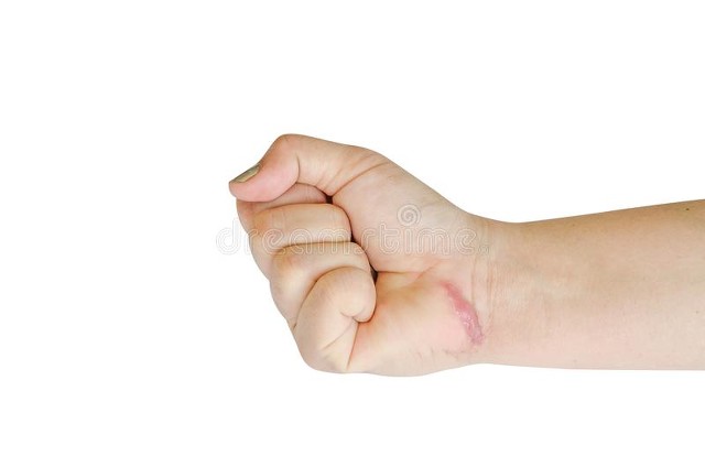 伤口增生怎么彻底治愈,伤口增生怎么能消除