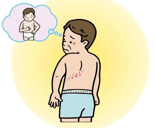 口腔2个病损，身上1炎1疹，可能是艾滋病来“敲门”，要当心