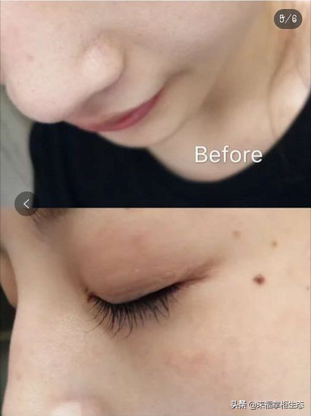 泥娃娃的面膜适合年轻人用吗,泥娃娃面膜适合年轻人使用吗