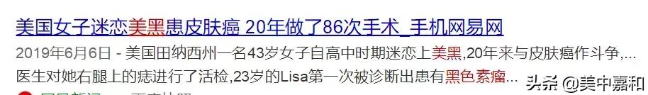 怎么区分黑痣与黑色素瘤,怎么区分黑色素瘤和痦子