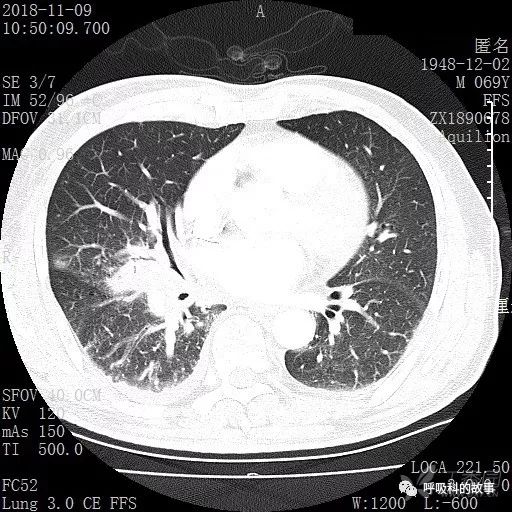 怎么应用统计学做调查,统计学方法可以解决的主要问题