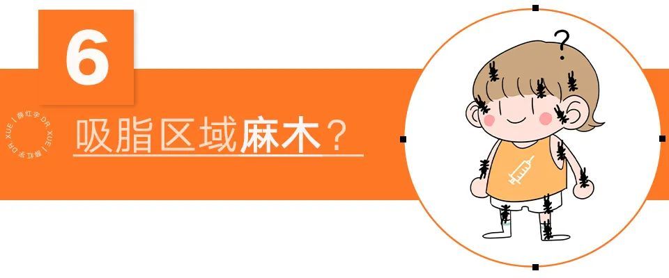 吸脂须知,吸脂必知