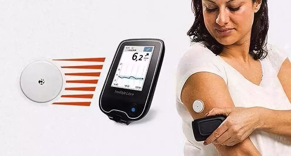 雅培动态血糖仪偏高还是偏低,雅培瞬感血糖仪怎么样