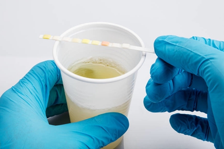 痛风治疗三剑客你了解多少,痛风分期是几期