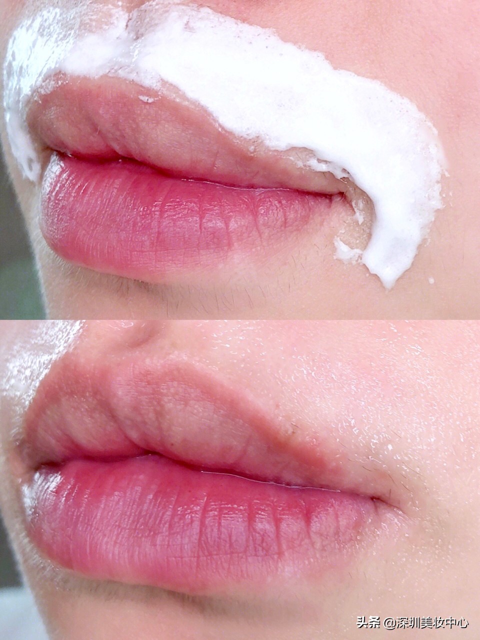 女孩如何消除嘴上的胡子,女生嘴唇去胡子妙招