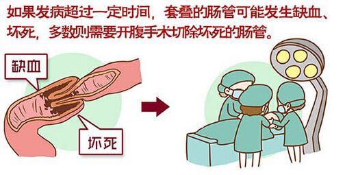 大肠套小肠是怎么回事,大肠疾病症状与治疗方法