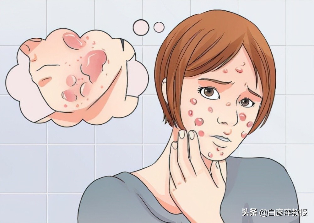 皮肤科医生眼中的真相,皮肤科激素皮炎