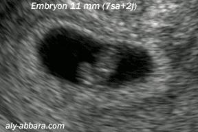 摸一下肚子就怀孕,都市传说怀孕