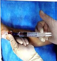 PICC冲管不当导致堵管，正确冲封管，你真的会了吗？