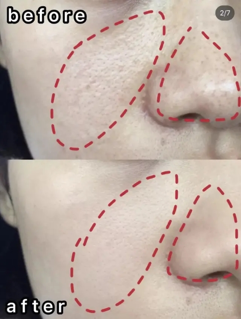 收缩毛孔提亮肤色李佳琦推荐,李佳琦缩毛孔控油