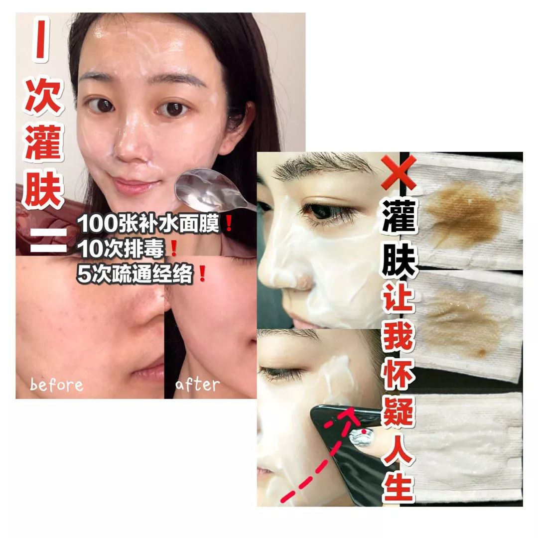 小红书祛痘最火的文章,小红书上教的祛痘方法真的有用吗