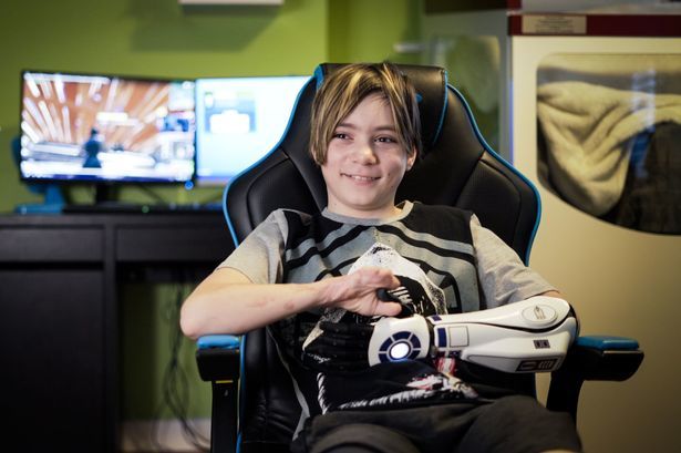 失去四肢的英国少年通过众筹，获《星球大战》仿生手臂得新生，