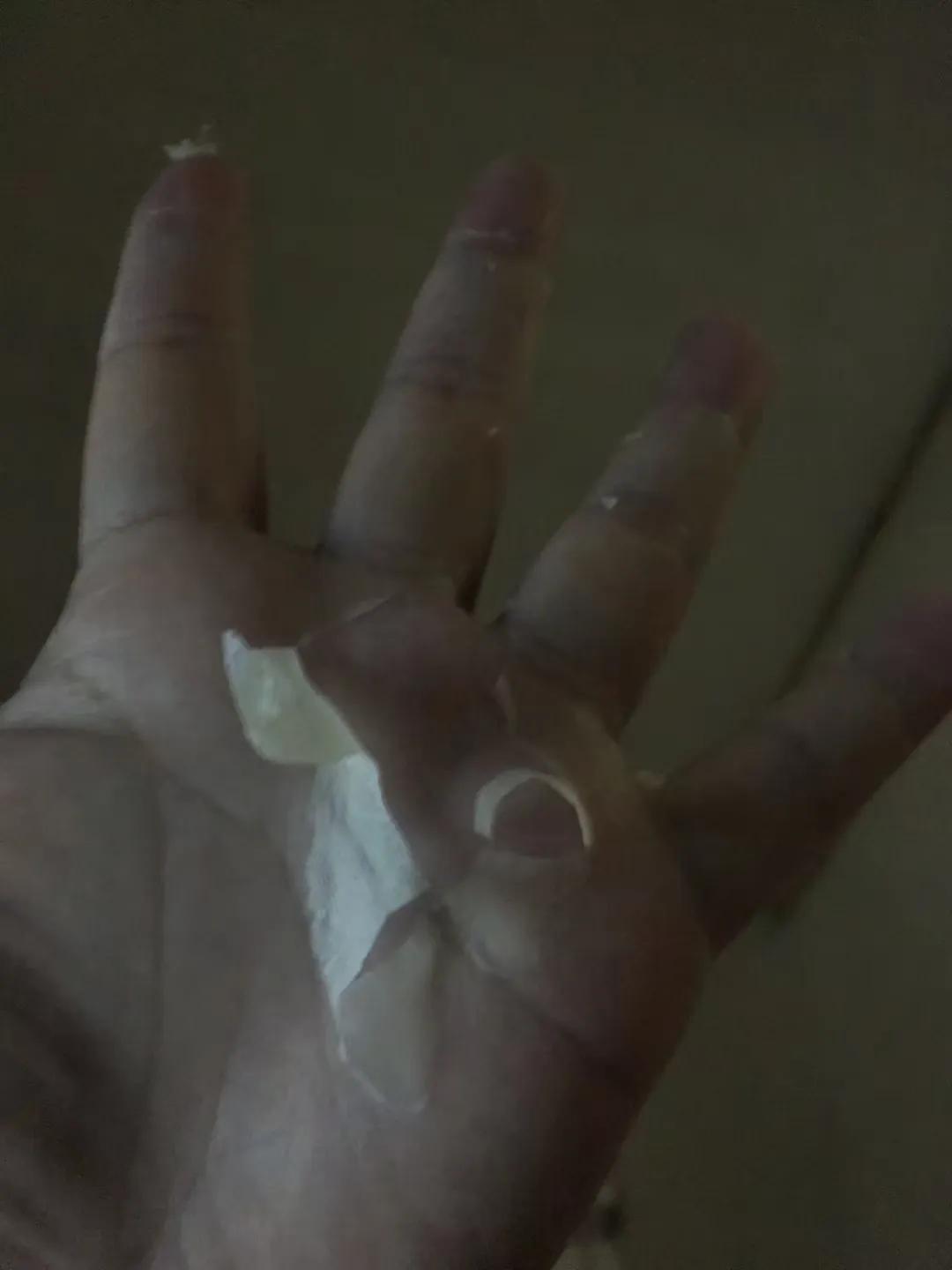 骨折人情冷暖,骨折后明白了人间冷暖