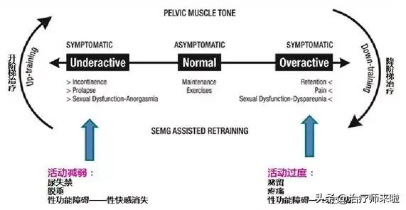 盆底功能障碍的康复——评估与治疗