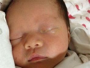 满月婴儿一只眼睛有眼屎流眼泪,刚满月的宝宝一只眼睛总是有眼屎