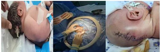 怎么判断胎儿是否颅脑畸形,健康知识胎儿