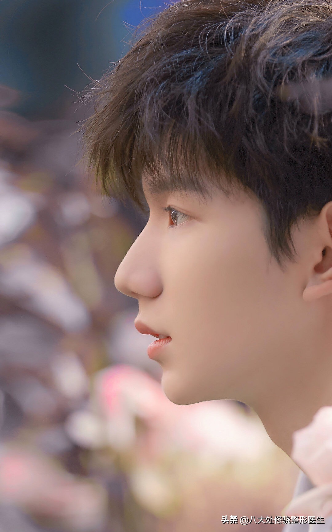 面部一枝花全靠鼻子当家,鼻子一针玻尿酸效果图