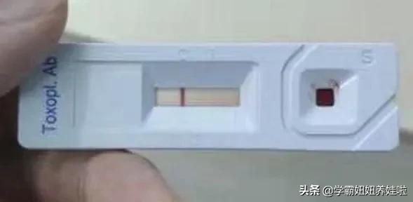 孕妇几个月就不怕得弓形虫了,孕期养宠物要做几次弓形虫检查