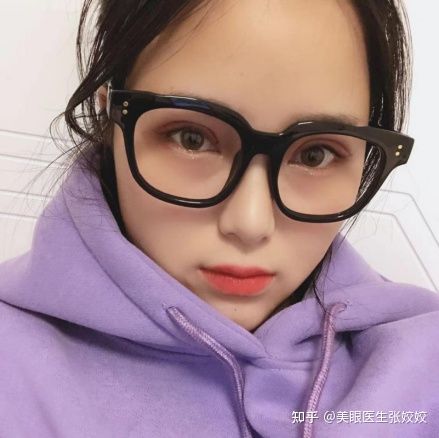 有没有割过眼袋后悔的,肿眼泡割双眼皮后悔率