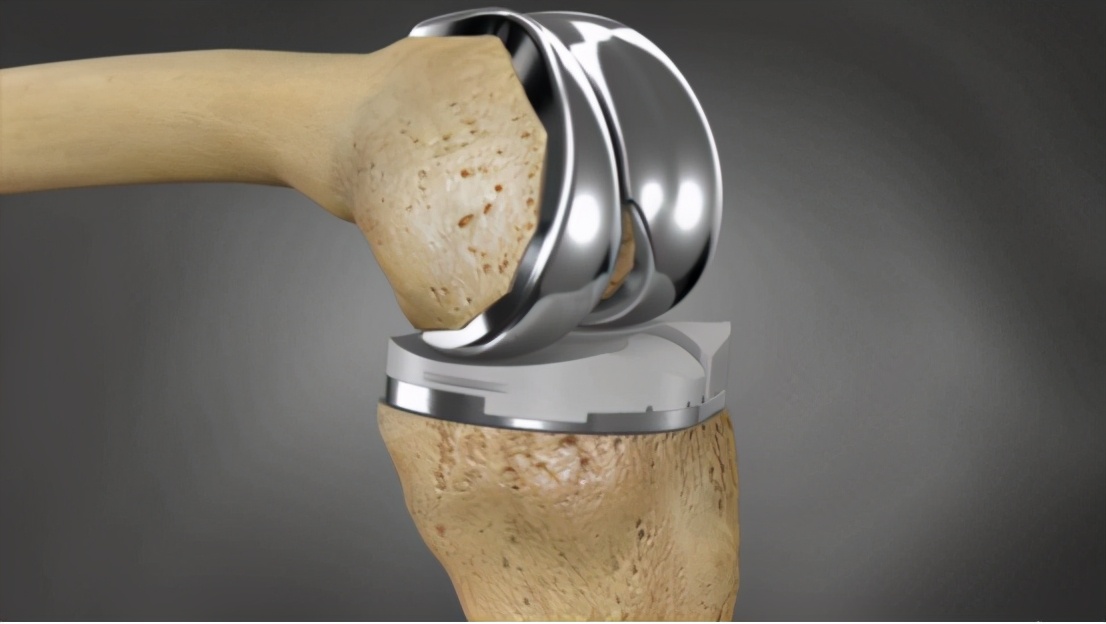 关节疼吃盐酸氨基葡萄糖管用吗,关节痛吃葡萄糖酸钙管用吗