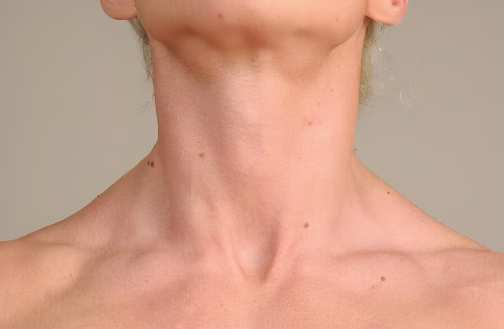 女人感染hpv脸上全部是斑,女人感染hpv脸上长痘严重吗