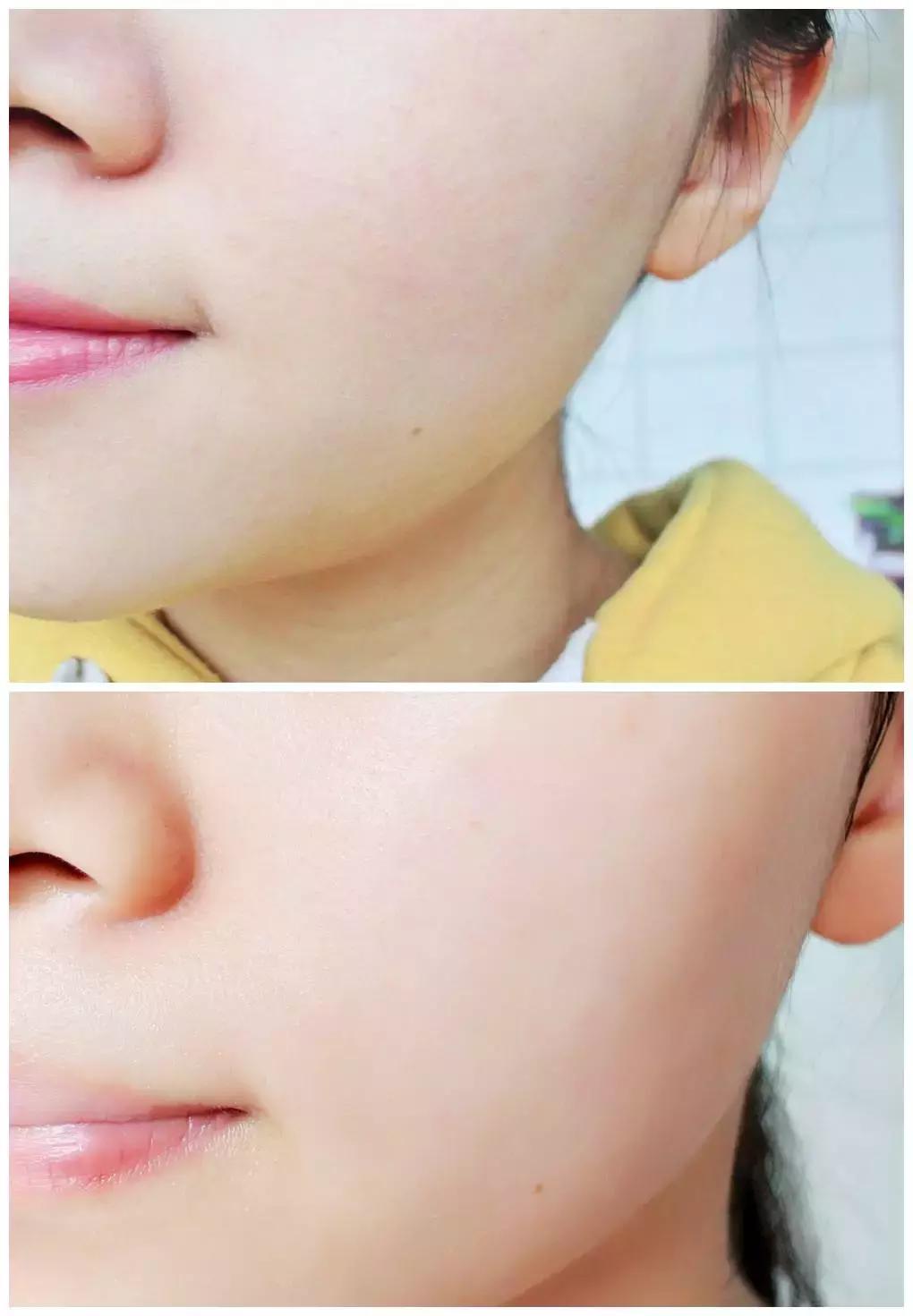 护肤反而皮肤差,改掉这些护肤恶习让你越变越美丽