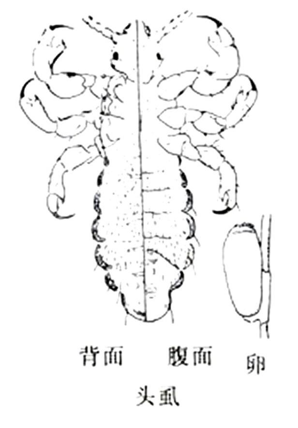 30年前每个人身上都有虱子,30年前人人都有的虱子为什么不见