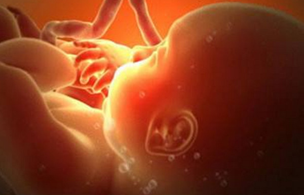 为啥孕妇的水叫羊水,胎儿在肚子里的水为什么叫羊水