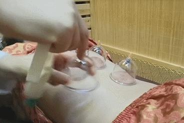 天津按摩刮痧,按摩保健拔罐刮痧店