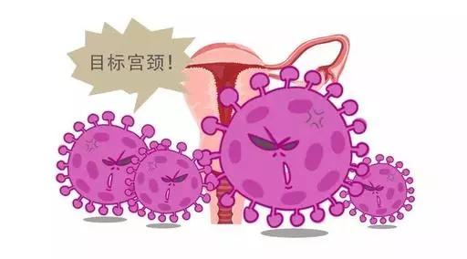 hpv和tct哪个是确诊宫颈癌的,呵护女性健康关注hpv
