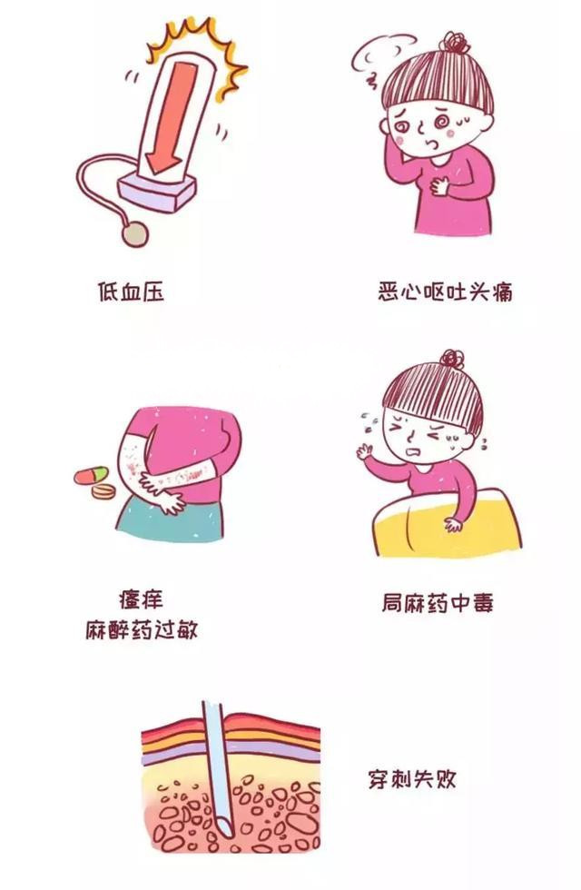 无痛分娩针=笑着生孩子？所有人都能打无痛分娩吗？有无副作用？