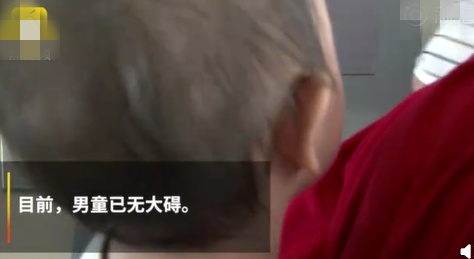 孩子被蚊虫叮咬怎么也不好怎么办,孩子被蚊虫叮咬几种方法辨别