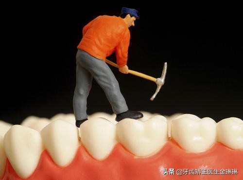 洗牙后牙难受怎么回事,洗牙后牙齿酸软是什么原因