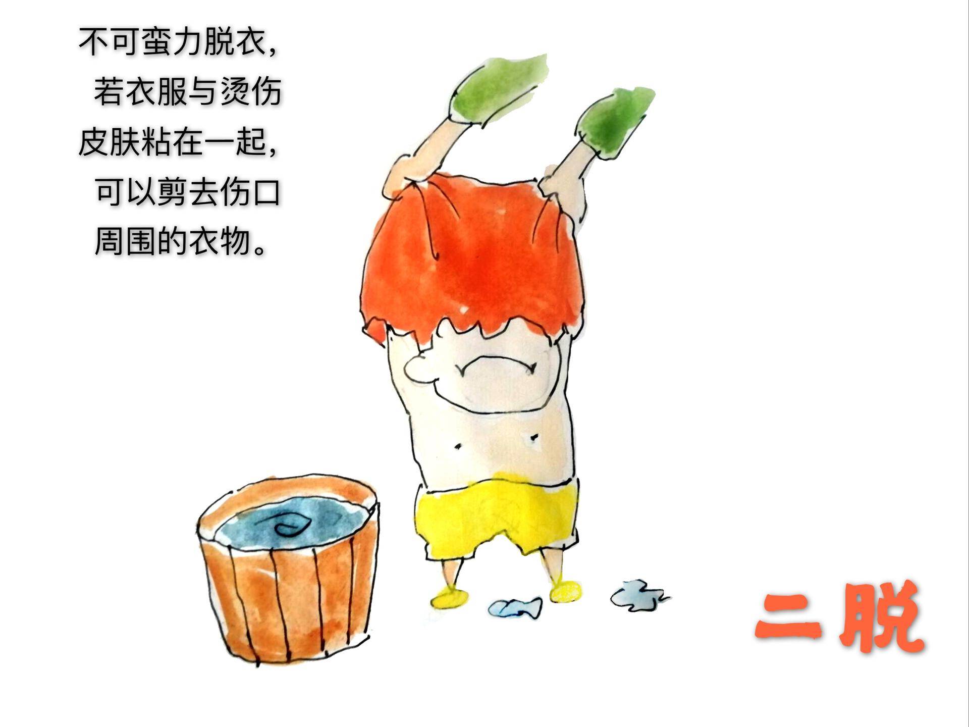 烫伤之后涂药怎么处理伤口,烫伤急救误区