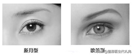 新月形双眼皮好看还是扇形好,新月型与平扇形双眼皮的区别
