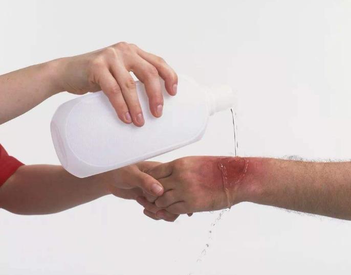 孩子被烫伤如何做心理疏导,小孩被烫伤最佳处理方法