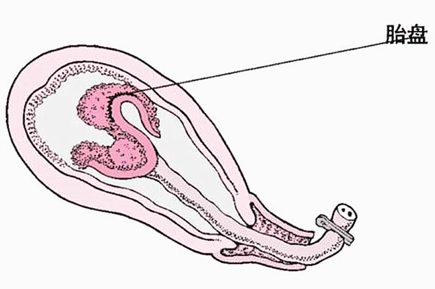 胎儿是如何从产道分娩出的,胎儿是怎么从狭小的产道出生的