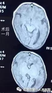 昭通第一人民医院早产儿科,昭通市第一人民医院儿外科