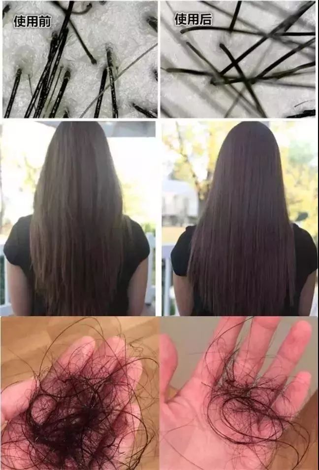 比较好用的德国防脱发,德国十大最好用的护肤品