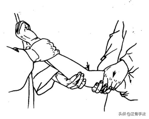 骨错则筋挪,关节脱位引起筋肉损伤时,4种整骨手法帮您复位