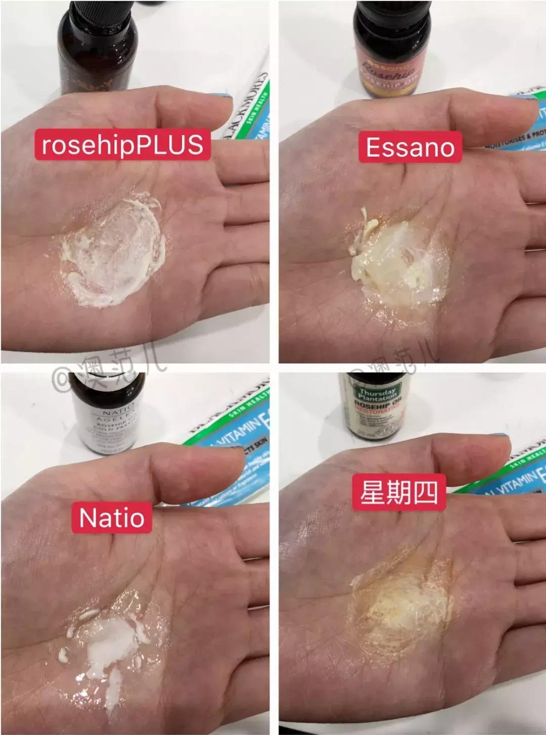 玫瑰果油护肤油好用吗,玫瑰果油效果怎么样