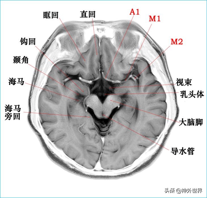 脑解剖学讲解视频全集,脑功能解剖学习