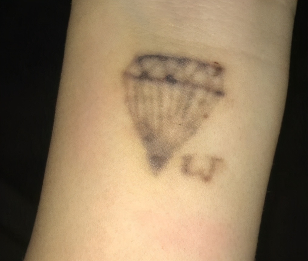 自己洗纹身最好的方法不留疤,洗纹身最好的方法不留疤多少钱