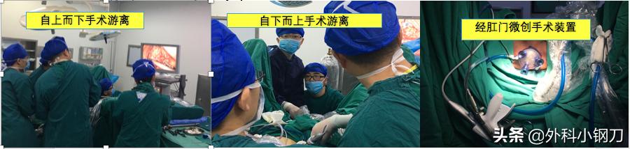 鍖荤敓鍓叉帀澶ц偁,鑲涢棬鍒囬櫎鍚庣画娌荤枟