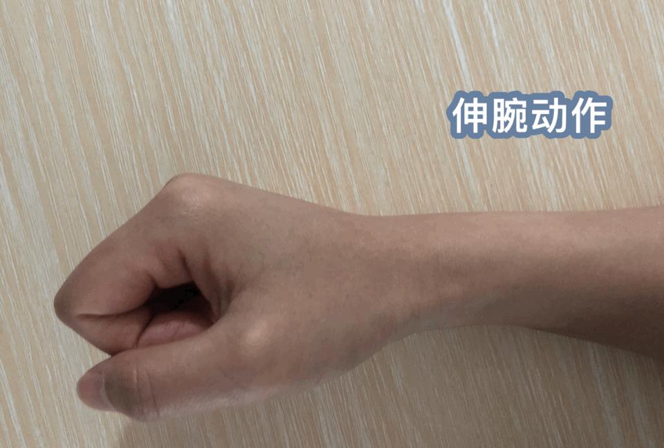 如何尽早摆脱网球肘的困扰,告别网球肘小妙招