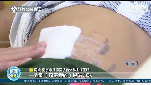 孩子误吞磁力珠医院视频,小孩误吞一颗磁力珠怎么办